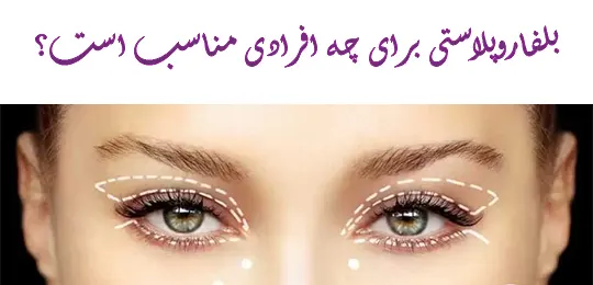 کاندیدای مناسب بلفاروپلاستی
