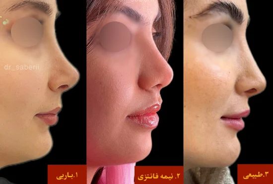 انواع مدل بینی