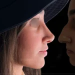 عمل زیبایی بینی
