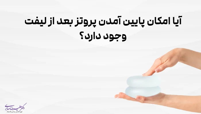 آیا امکان پایین آمدن پروتز بعد از لیفت وجود دارد؟