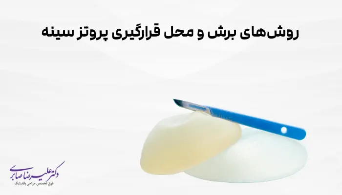 روشهای برش و محل قرارگیری پروتز سینه