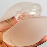 پارگی پروتز