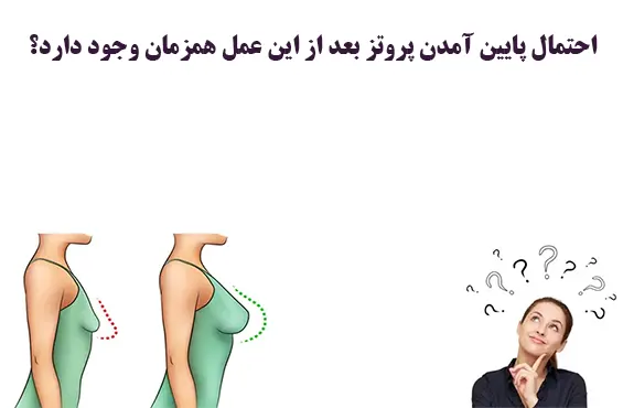  پایین آمدن پروتز بعد از این عمل همزمان