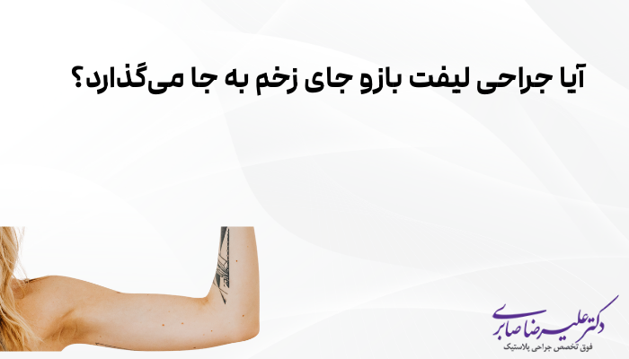 آیا جراحی لیفت بازو جای زخم به جا میگذارد؟