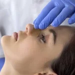 برداشتن گچ بینی