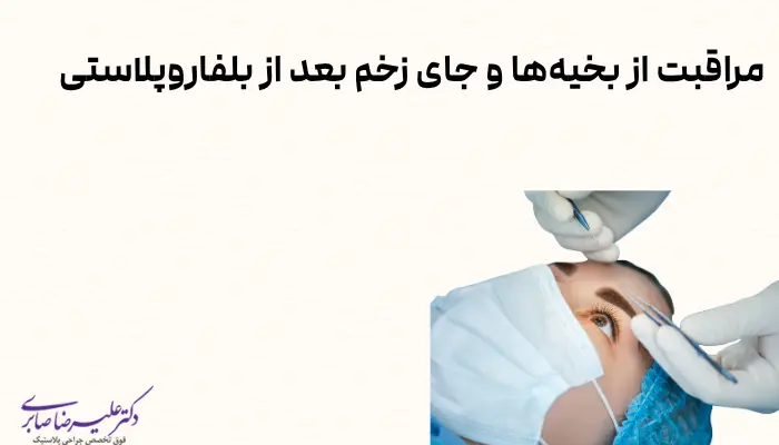 مراقبت از بخیهها و جای زخم بعد از بلفاروپلاستی