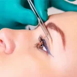 مراقبت بعد از عمل افتادگی پلک