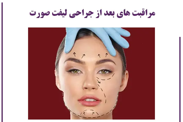 مراقبت  های بعد از عمل لیفت صورت