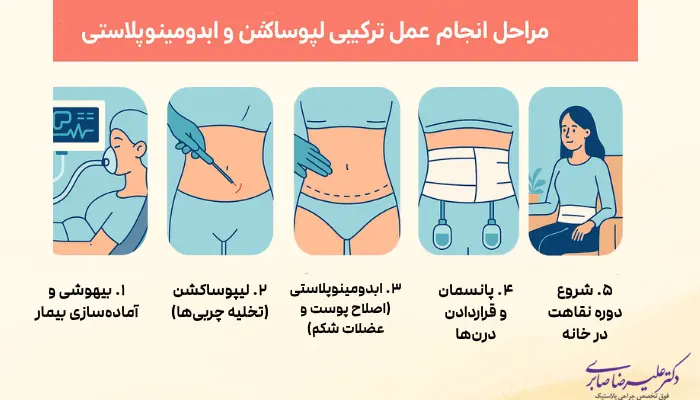 مراحل انجام عمل ترکیبی لیپوساکشن و ابدومینوپلاستی
