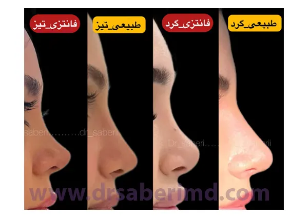 انواع مدل های بینی دکتر صابری