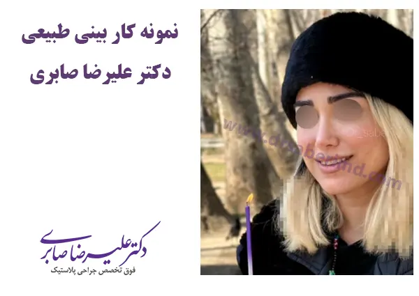 بهترین دکتر برای عمل بینی طبیعی در تهران
