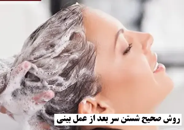 روش صحیح شستن سر بعد از عمل بینی