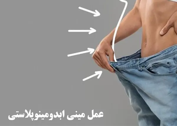 عمل مینی ابدومینوپلاستی