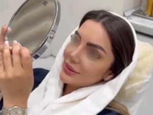 نمونه کار جراح پنجه طلای بینی ایران