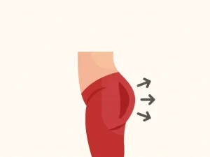 ترانسفر چربی به باسن؛ برجسته سازی باسن با تزریق چربی