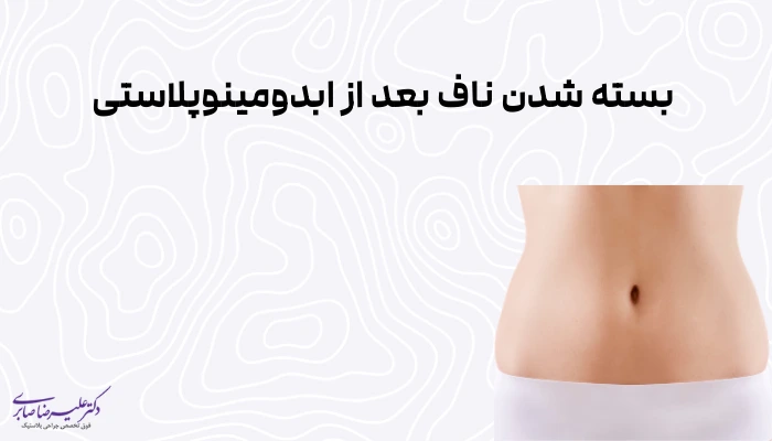 بسته شدن ناف بعد از ابدومینوپلاستی