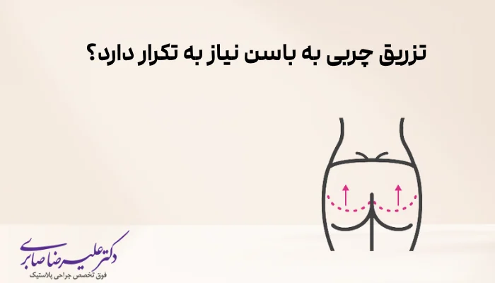 تزریق چربی به باسن نیاز به تکرار دارد؟