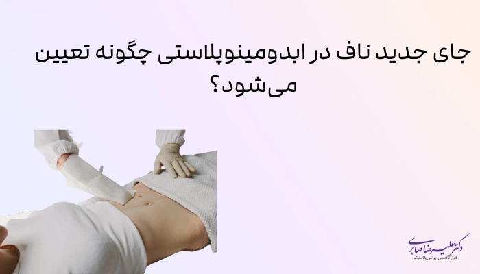 جای جدید ناف در ابدومینوپلاستی چگونه تعیین میشود؟