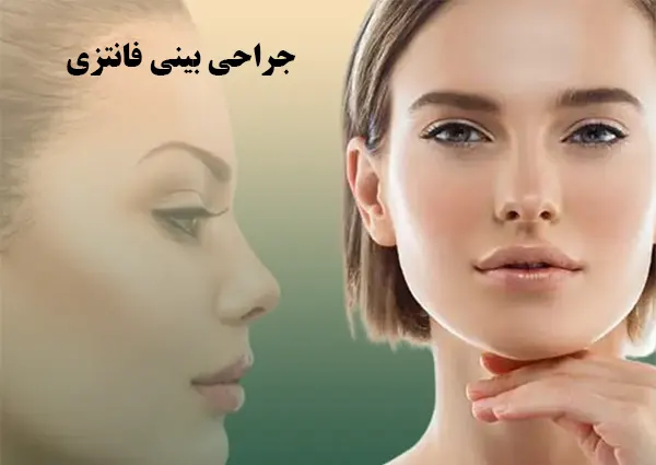 جراحی بینی فانتزی 