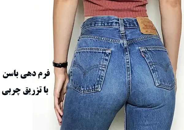 فرمدهی باسن با با تزریق چربی