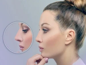 جراحی بینی با روش جدید