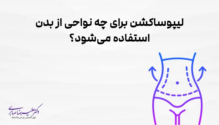 لیپوساکشن برای چه نواحی از بدن استفاده میشود؟