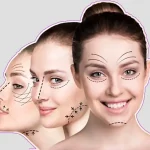 مینی فیس لیفت