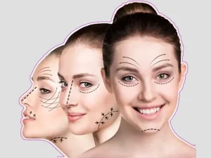 مینی فیس لیفت