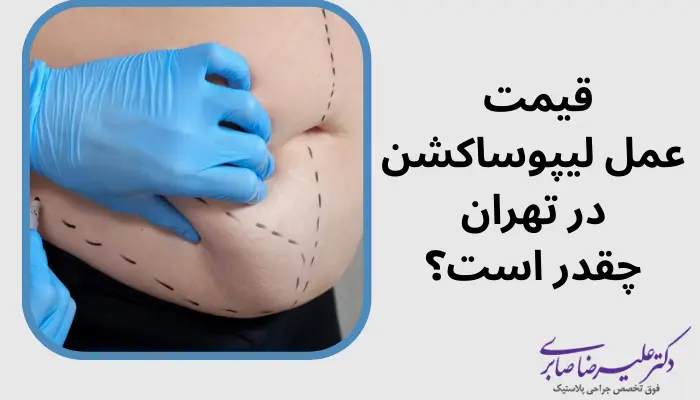 هزینه لیپوساکشن در تهران 1404 