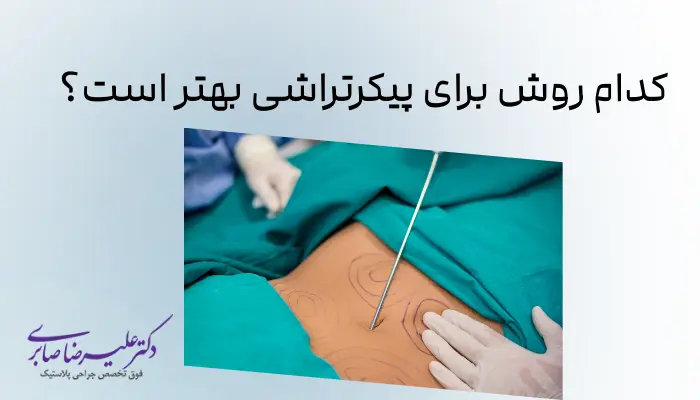 کدام روش برای پیکرتراشی بهتر است؟