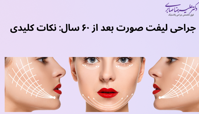 جراحی لیفت صورت بعد از ۶۰ سال: نکات کلیدی جراحی لیفت صورت بعد از ۶۰ سال: نکات کلیدی