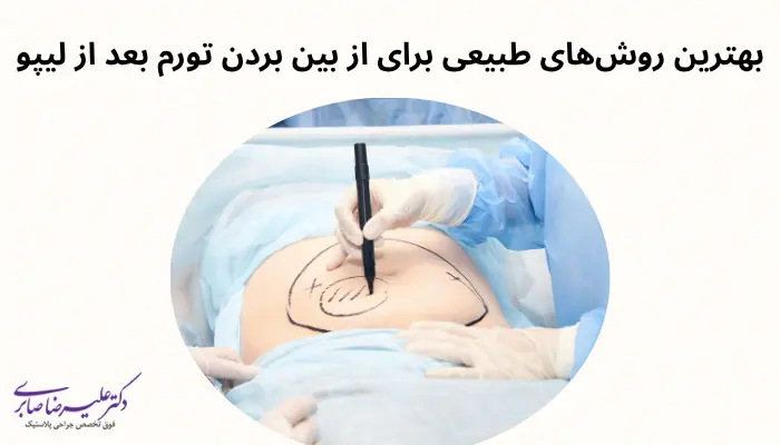 بهترین روشهای طبیعی برای از بین بردن تورم بعد از لیپو بهترین روشهای طبیعی برای از بین بردن تورم بعد از لیپو