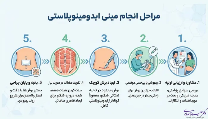 مراحل انجام مینی ابدومینوپلاستی