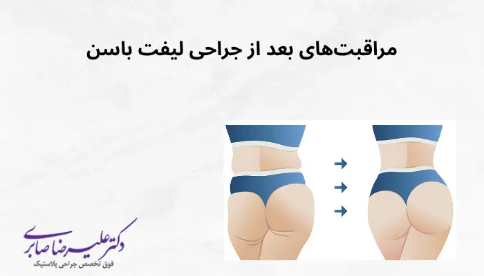 مراقبتهای بعد از جراحی لیفت باسن مراقبتهای بعد از جراحی لیفت باسن