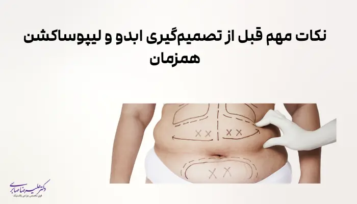 نکات مهم قبل از تصمیمگیری ابدو و لیپوساکشن همزمان