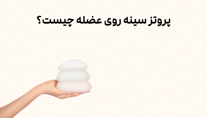 پروتز سینه روی عضله چیست؟